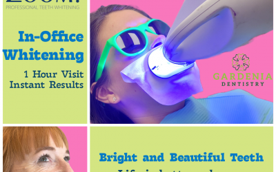 The Benefits of Zoom Teeth Whitening: A Bright Choice for a Dazzling Smile
